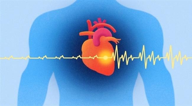 الرجفان الأذيني قبل الـ 65 يؤثر على الدماغ